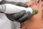 Thermage pro muže, nebo chirurgický facelift? Co si vybrat?